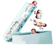 体外受精 IVF-ET